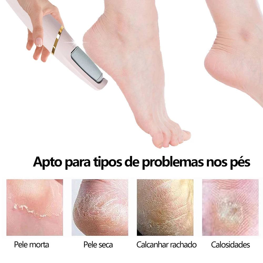 Lixa Elétrica para os Pés Soft Skin - Loja Marviva