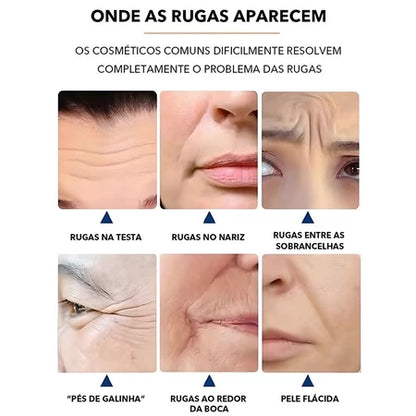 Kit Rejuvene Clean - Adesivos Anti-Rugas das famosas (Reutilizável - até 40 aplicações)
