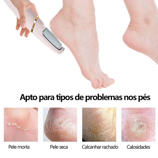 Lixa Elétrica para os Pés Soft Skin - Loja Marviva